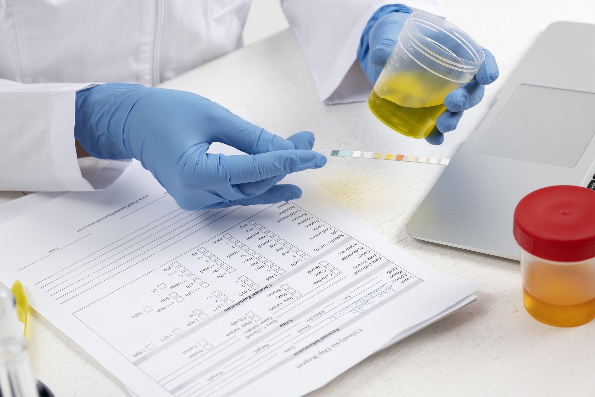 Thanyapura-Sports-Health-Resort-lab-doctor-performing-medical-exam-urine1